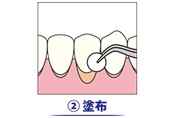 2.塗布