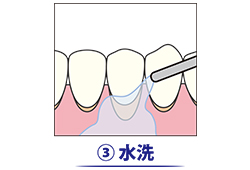 3.水洗